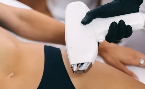 Intense Pulsed Light (IPL) Vein Care