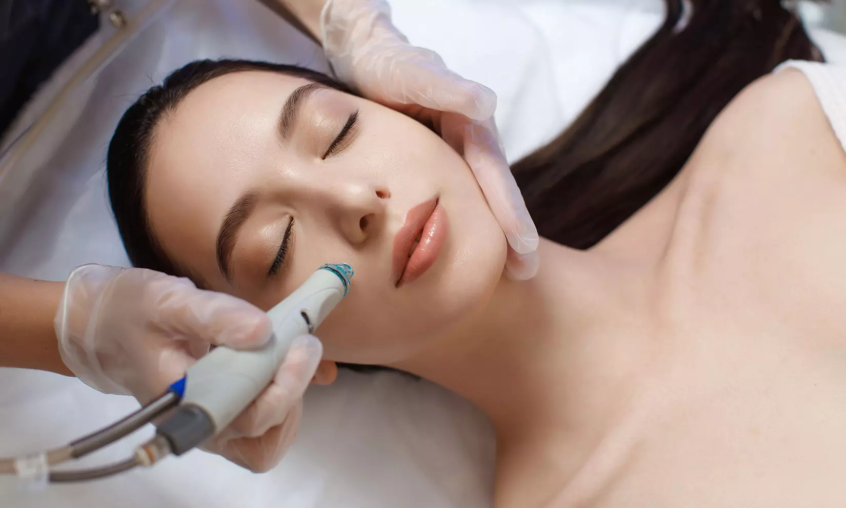 Microdermabrasion