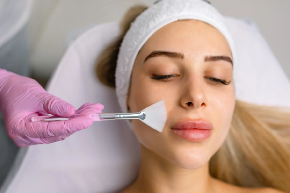 Chemical Peels